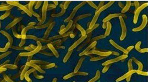 微生物菌劑好？好在哪里您知道嗎？